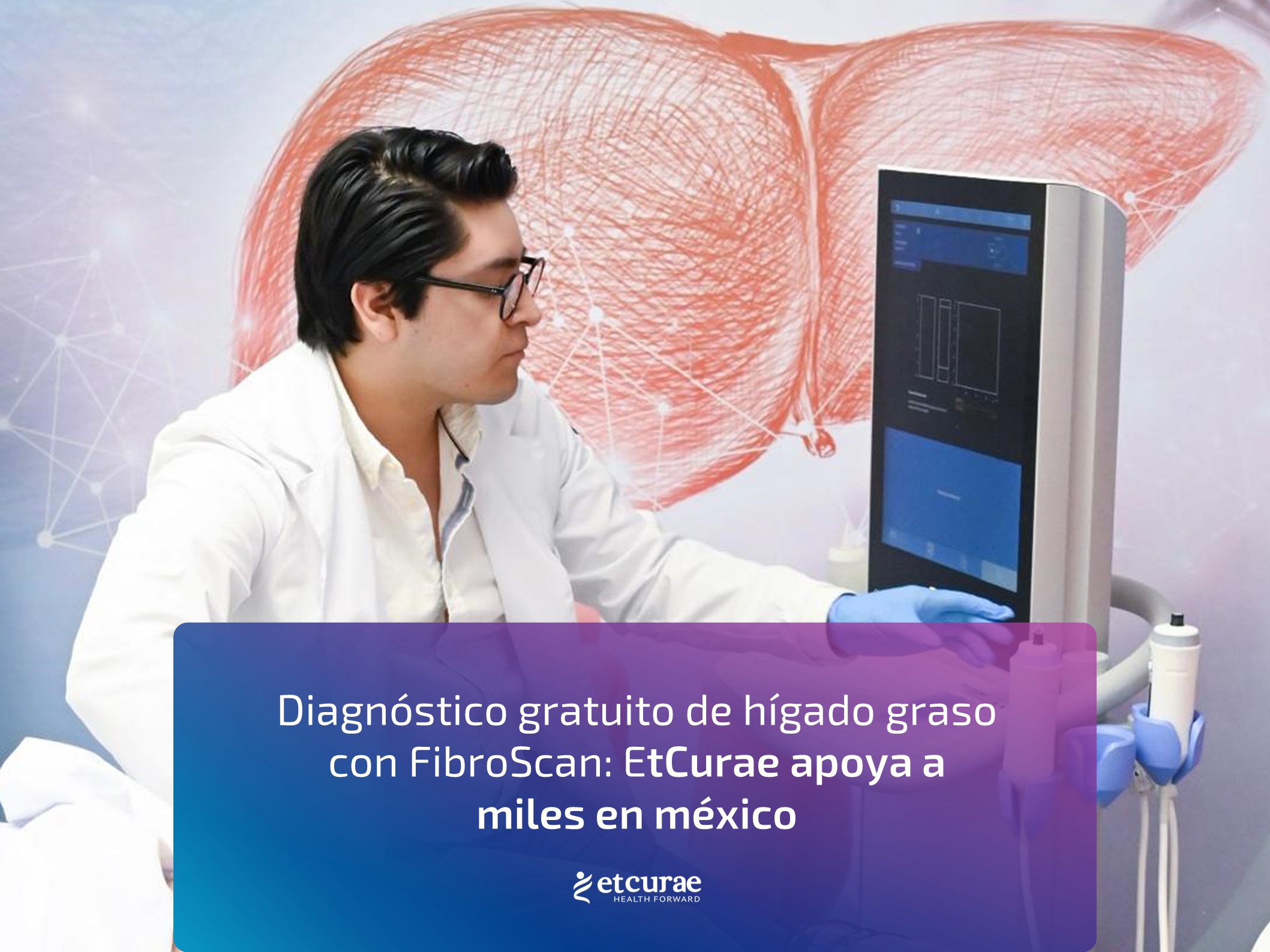 Diagnóstico gratuito de hígado graso con FibroScan: EtCurae apoya a miles en méxico